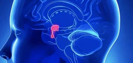 Sintomi e diagnosi, strategie terapeutiche più efficaci per il trattamento degli adenomi ipofisari: interventi chirurgici, radioterapia, terapie farmacologiche e monitoraggio a lungo termine