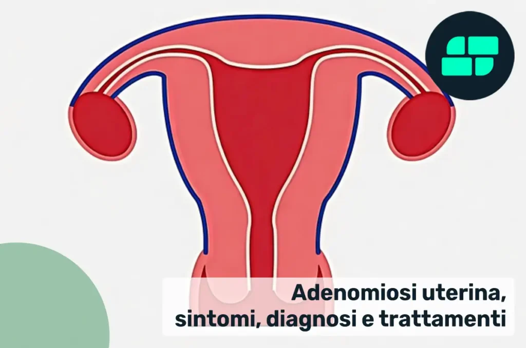 Adenomiosi uterina