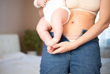 Integrare nutrienti chiave, mantenere un'adeguata idratazione e seguire le linee guida alimentari supporta non solo la guarigione fisica, ma anche la produzione di latte e il benessere emotivo della madre