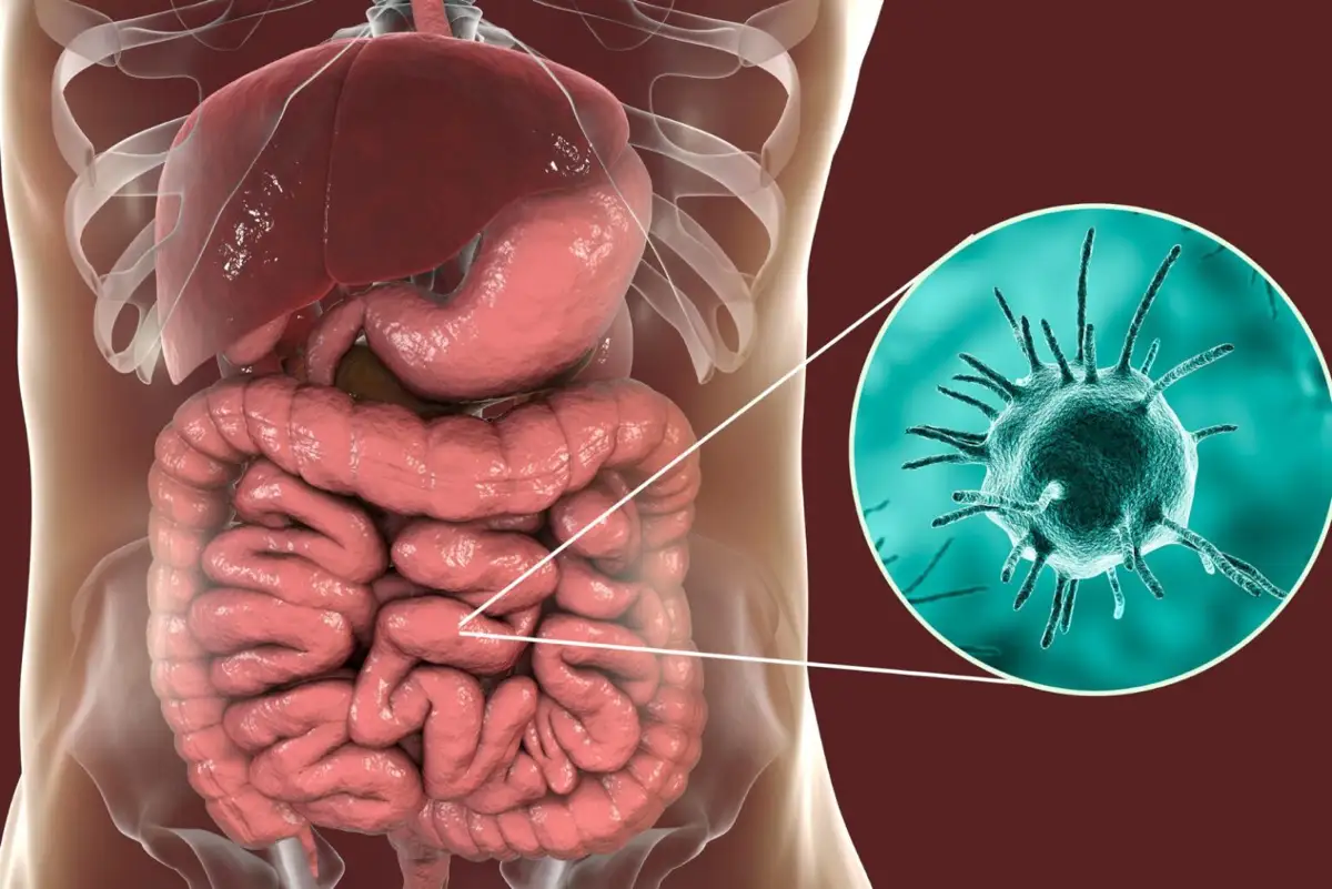 Amebiasi Sintomi e Diagnosi dell’infezione parassitaria intestinale