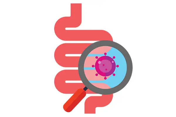 Cresce il cancro al colon tra i giovani: cibi ultraprocessati tra le cause principali
