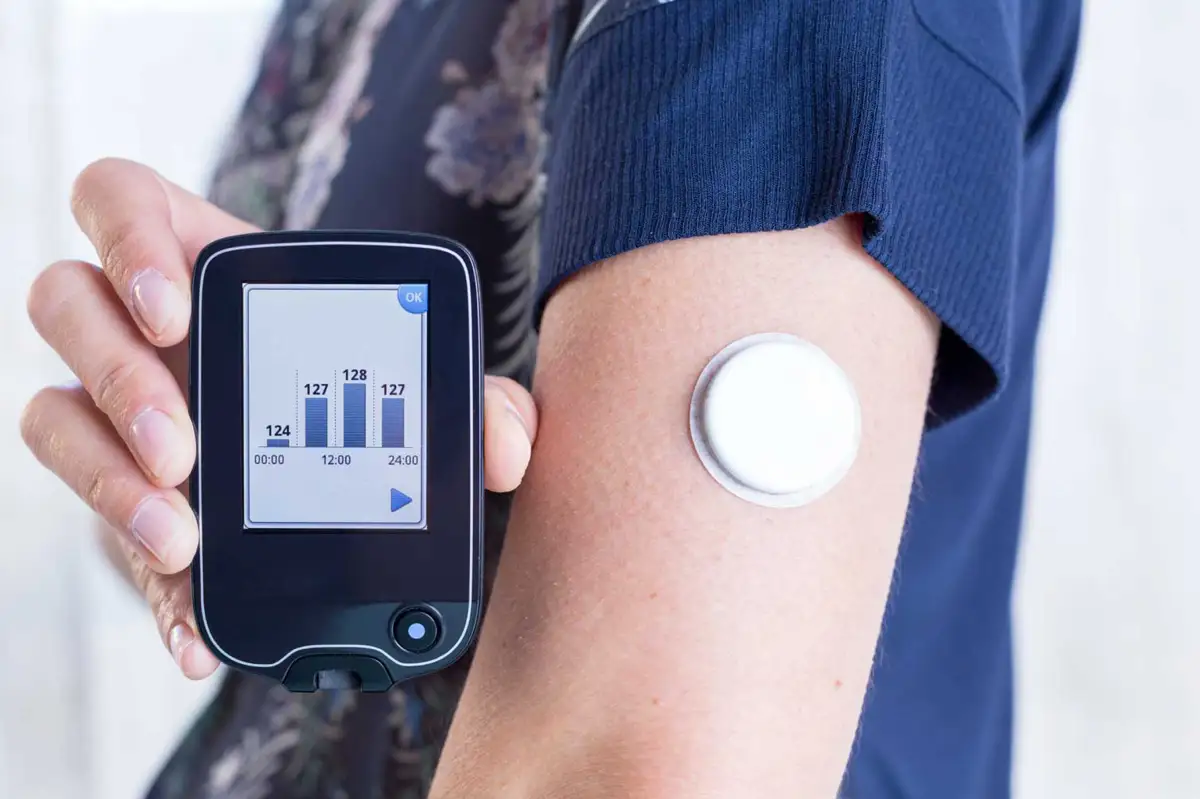 Cresce l’uso dei dispositivi indossabili per tracciare la glicemia, ma sono efficaci per tutti?