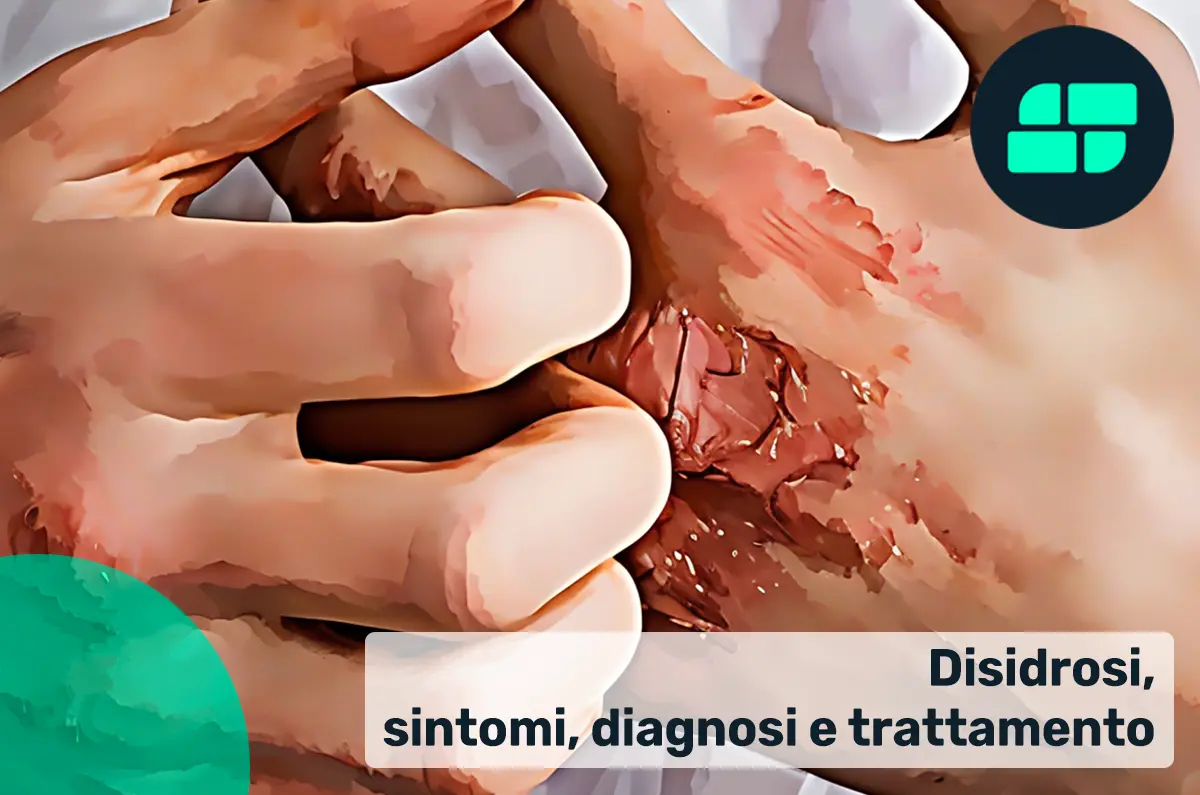 Sintomi disidrosi