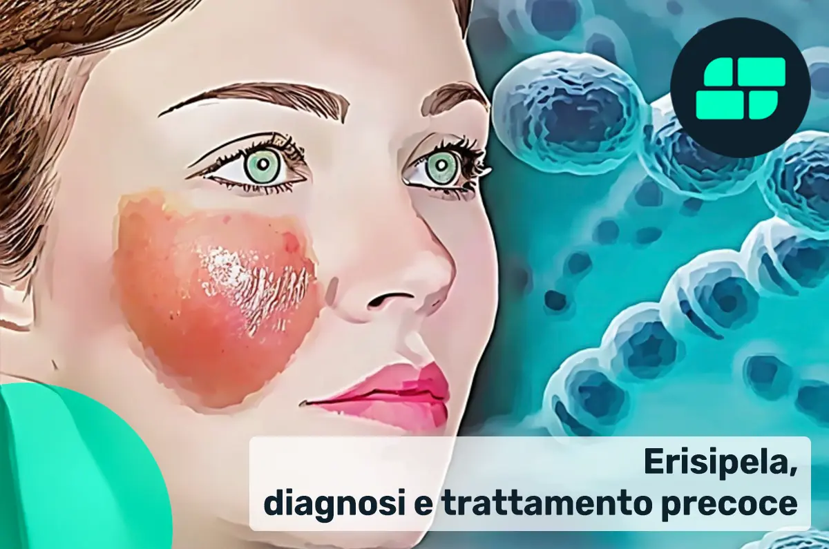 Erisipela