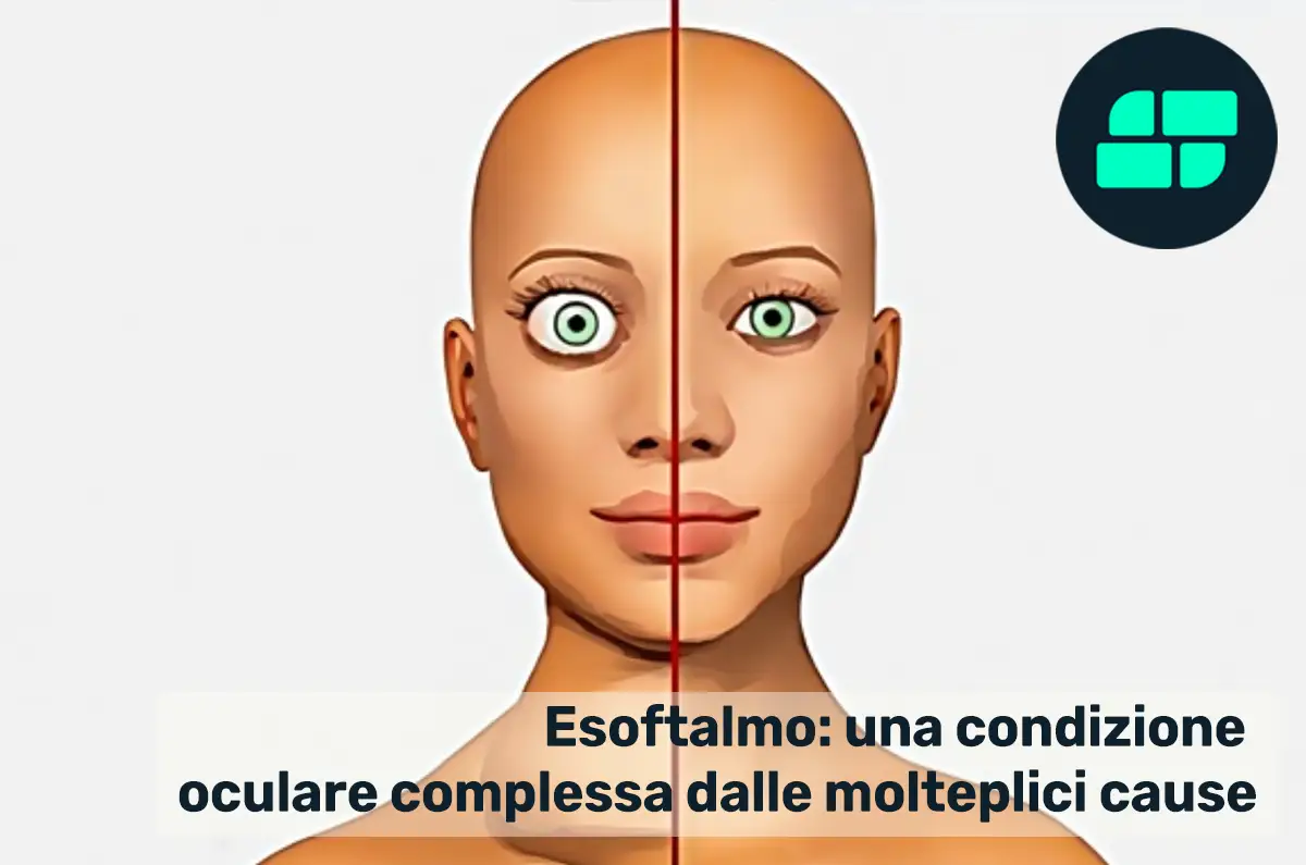 Esoftalmo