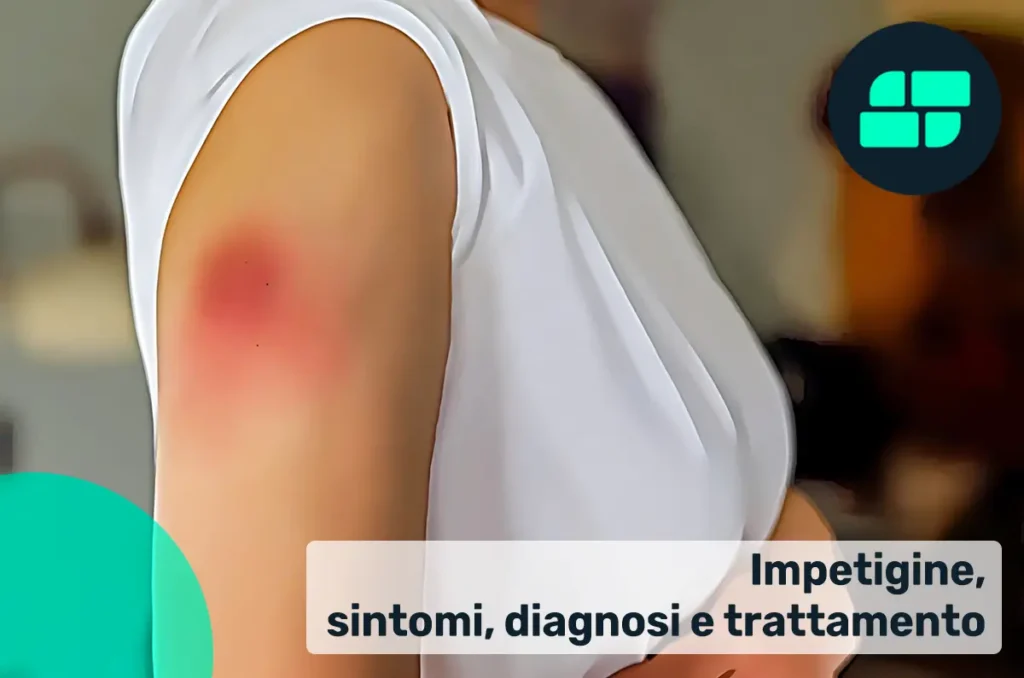 Sintomi impetigine