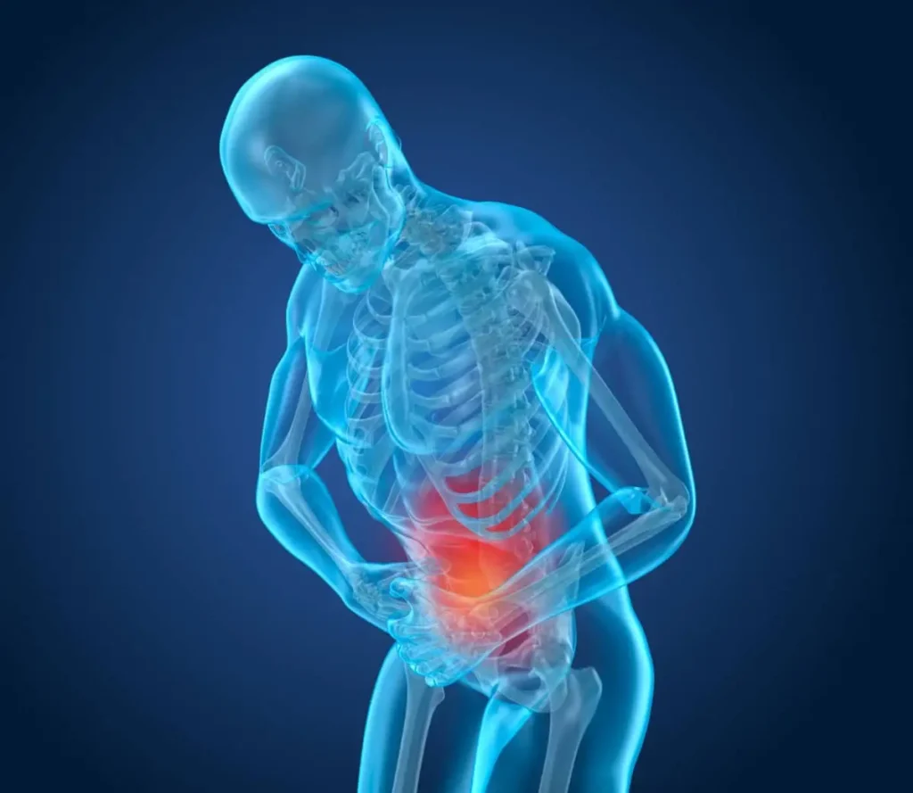 Sintomi, cause e diagnosi dell'occlusione intestinale