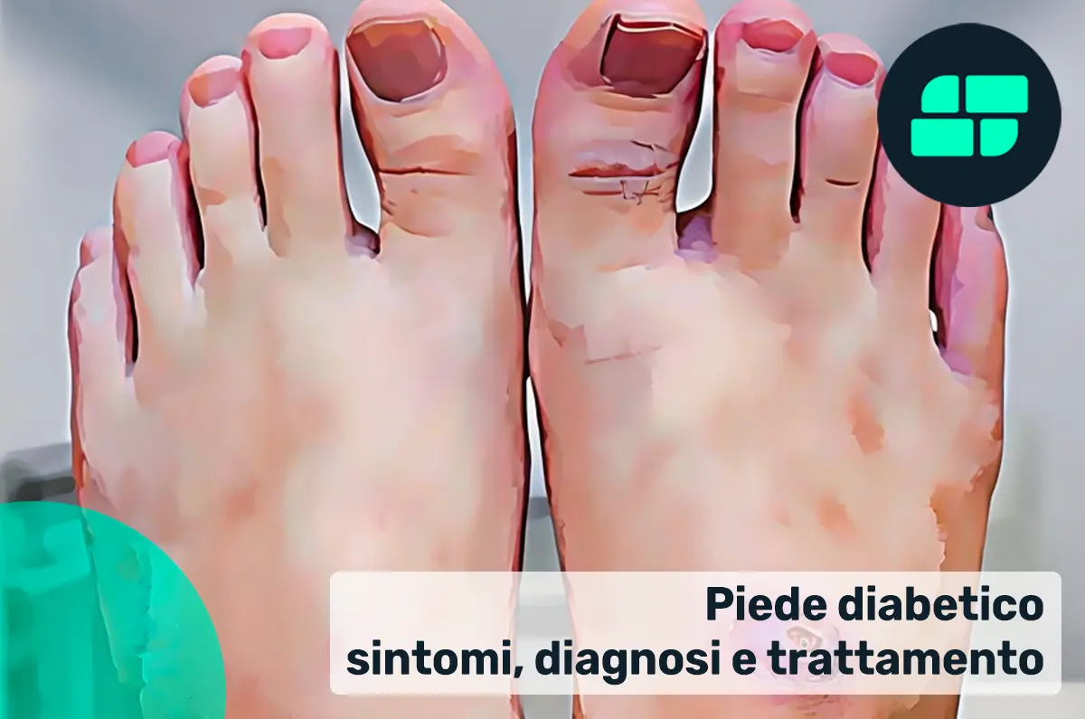 Piede diabetico