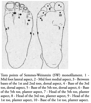 Semmes-Weinstein Monofilament Test (SWMT)