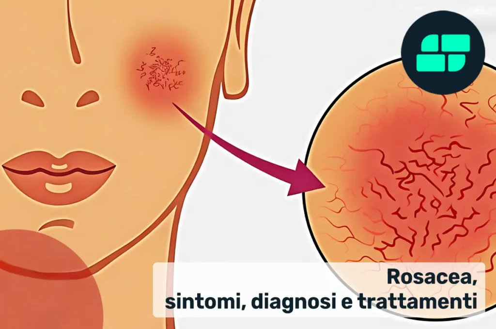 Rosacae