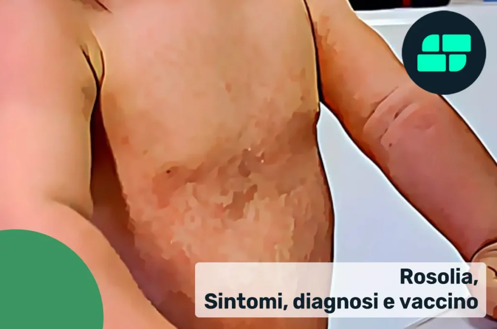 Sintomi Rosolia
