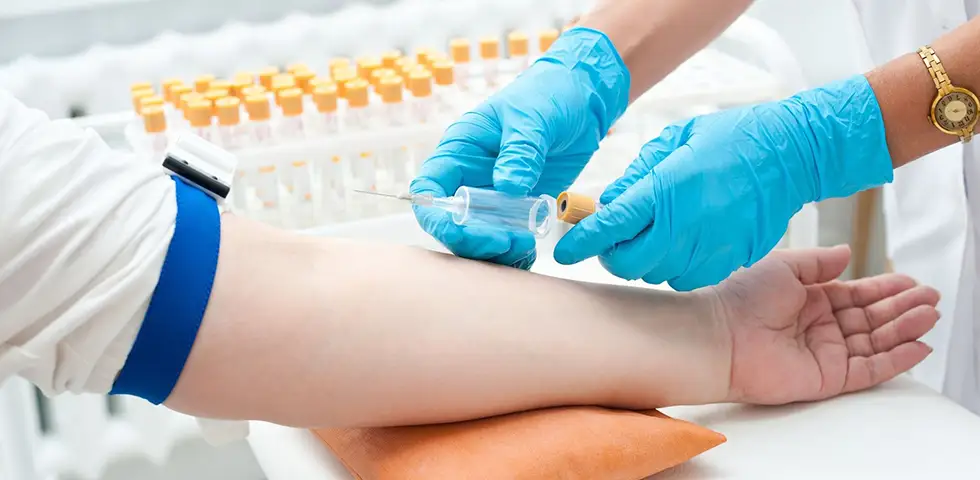 Sideremia (sintomi quando è alta o bassa), perché viene richiesta