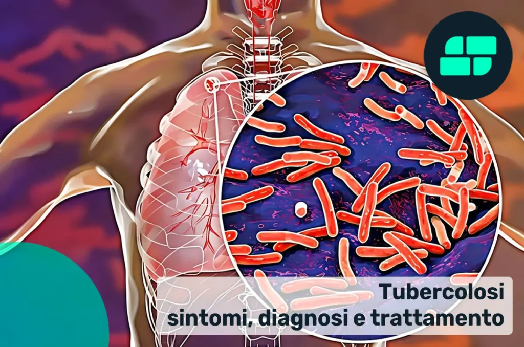 Tubercolosi