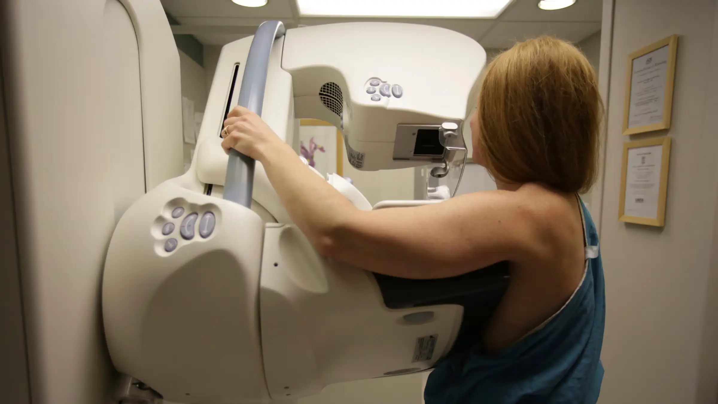 Tumore al seno, la necessità di anticipare lo screening a 45 anni