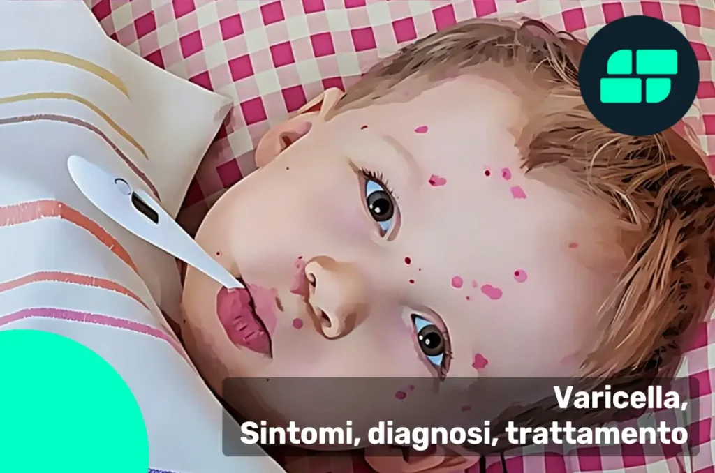 Varicella
