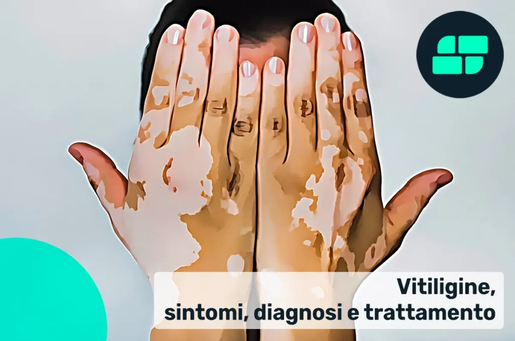 Vitiligine